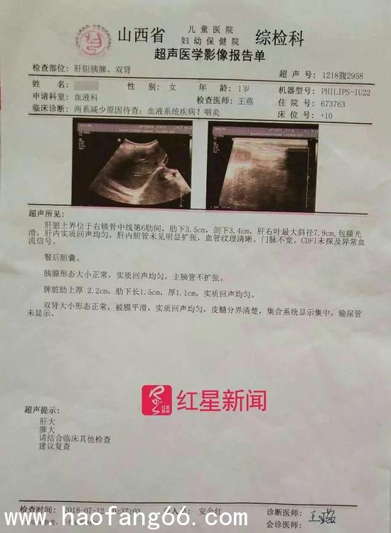 ▲高珊超声波检查单